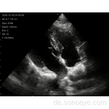 Pocketyp Phased Array Color Doppler Ultraschall